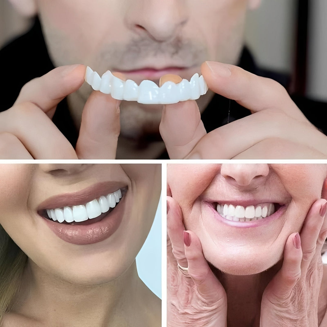 Cosmetic Tooth Covers with Snap-On Design and 2-Piece Set