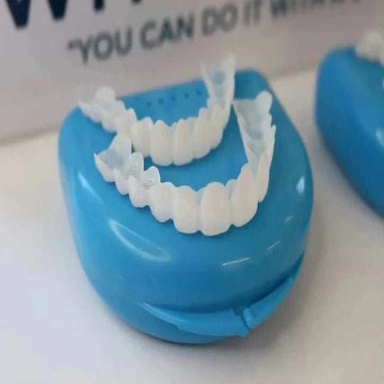 Cosmetic Veneers with Clip-On Design and Temporary Covers