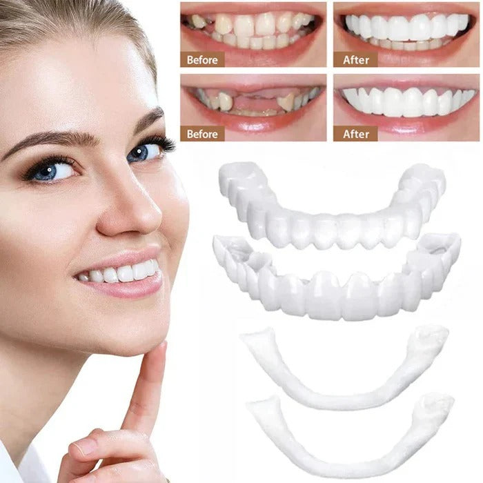 Cosmetic Veneers with Clip-On Design and Temporary Covers