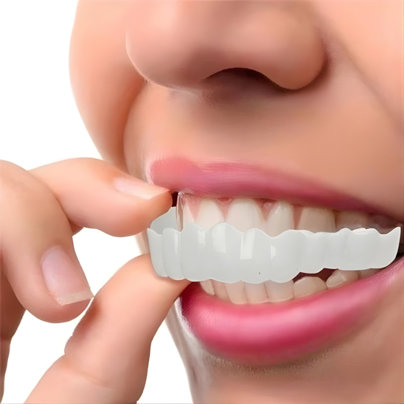 Dental Veneer Kit with Upper and Lower Covers