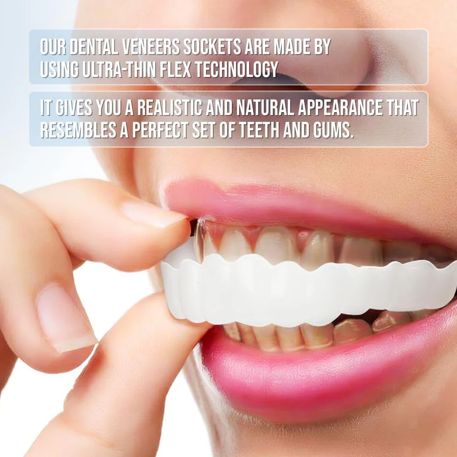 Dental Veneer Kit with Upper and Lower Covers