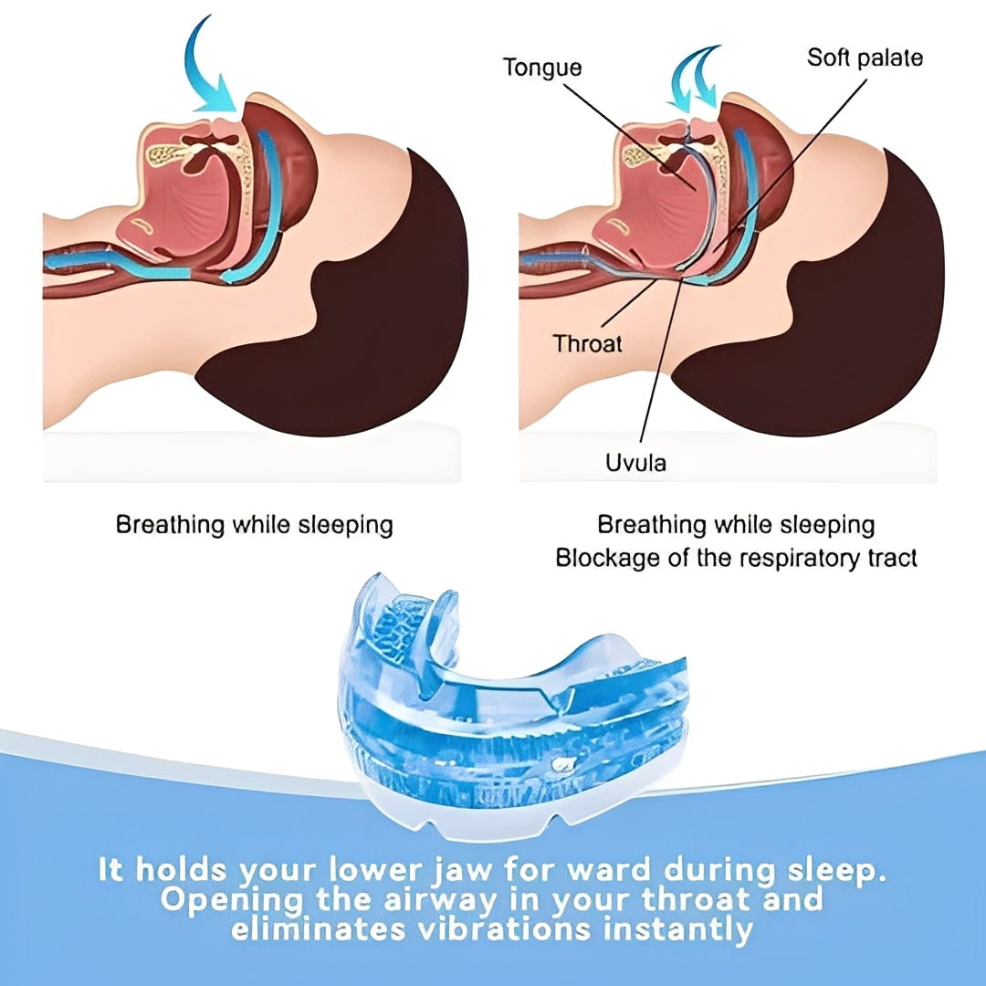 Mouthguard with Adjustable Fit and Custom Moldable Design