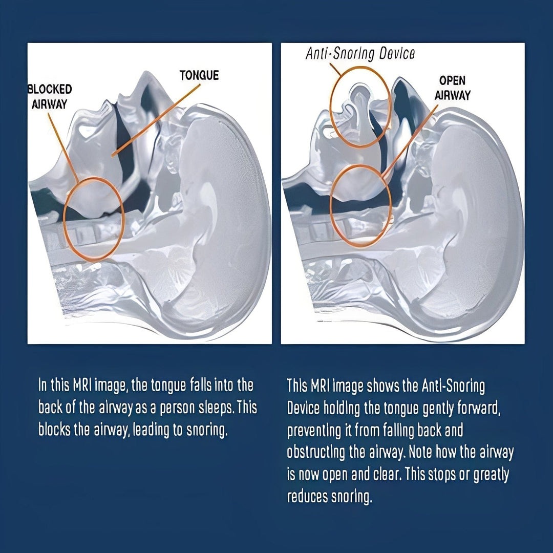 Sleep Aid with Tongue Positioning and Airflow Support